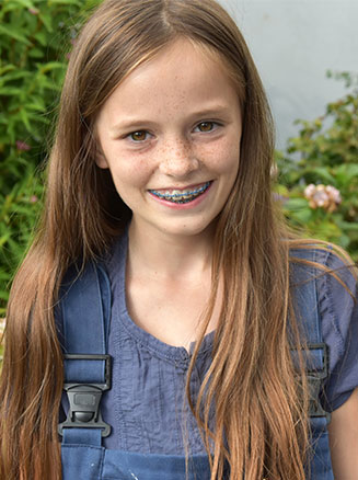 early orthodontic treatment